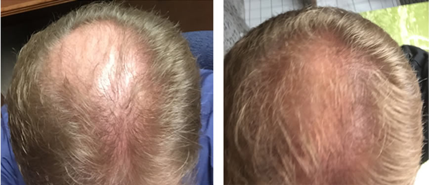 9 Months